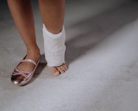 Close-up van het been van een kind in het gips met een roze schoentje